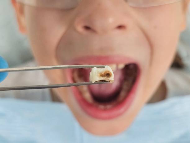 Best Urgent Tooth Repair  in Easton, PA